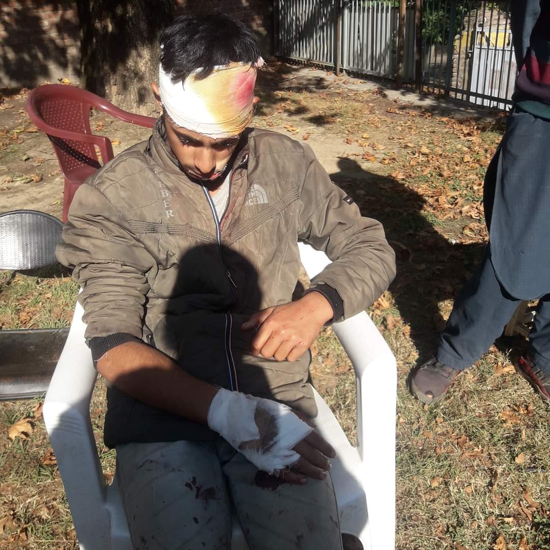Teenager Boy wounded in bear attack in Lar Ganderbal