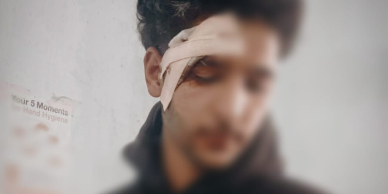 Youth injured after being attacked in Ganderbal